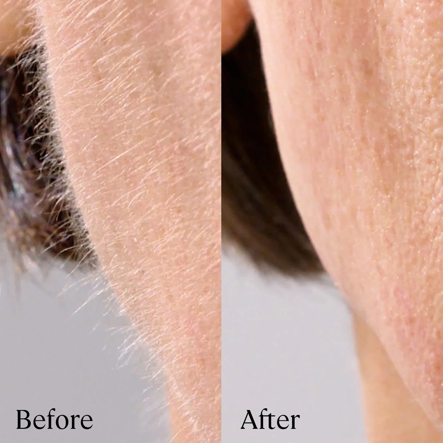 Luxe's Peach Fuzz Removal Cream
