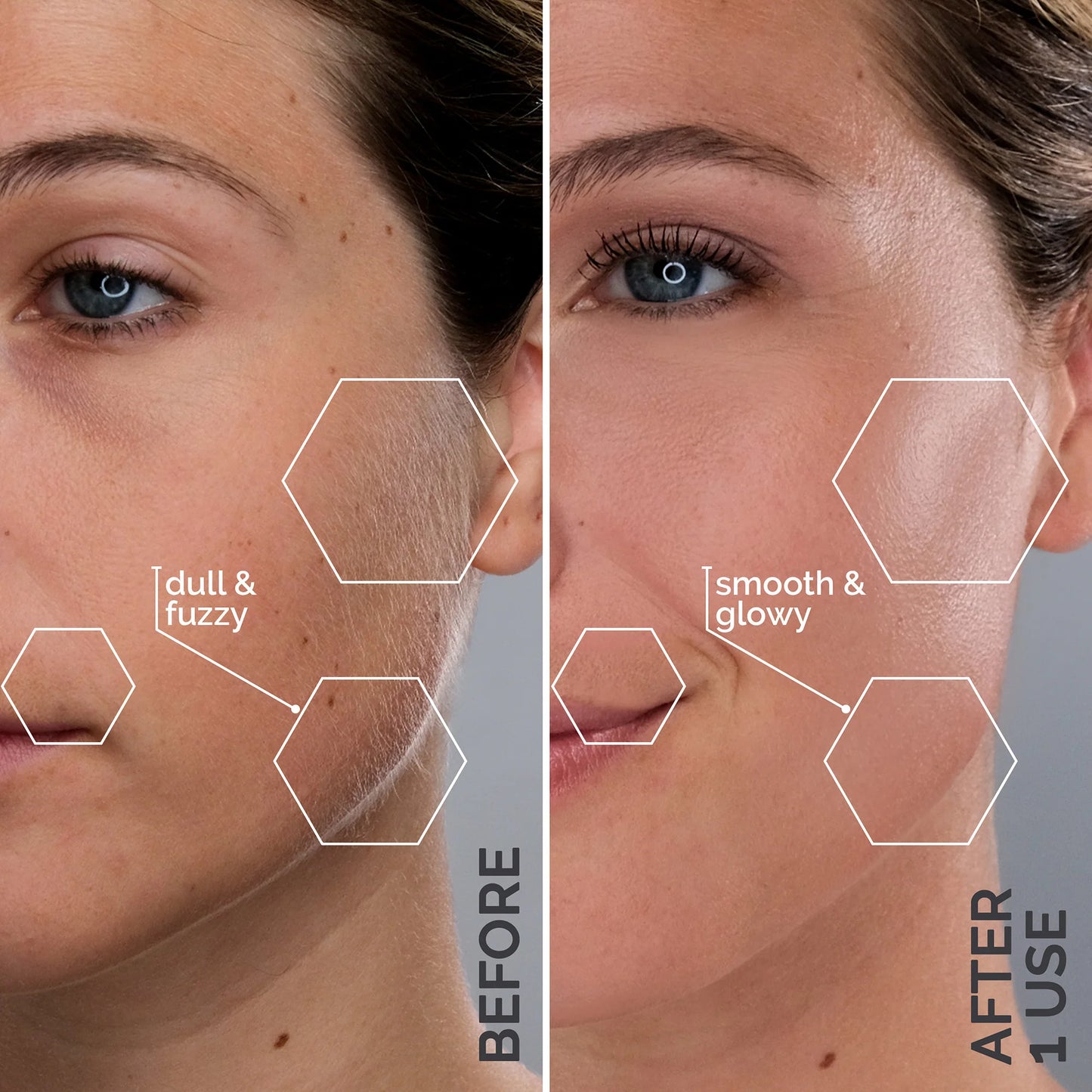 Luxe's Peach Fuzz Removal Cream