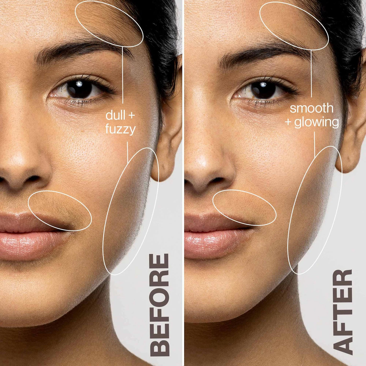 Advanced Ai Epilator