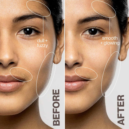 Advanced Ai Epilator